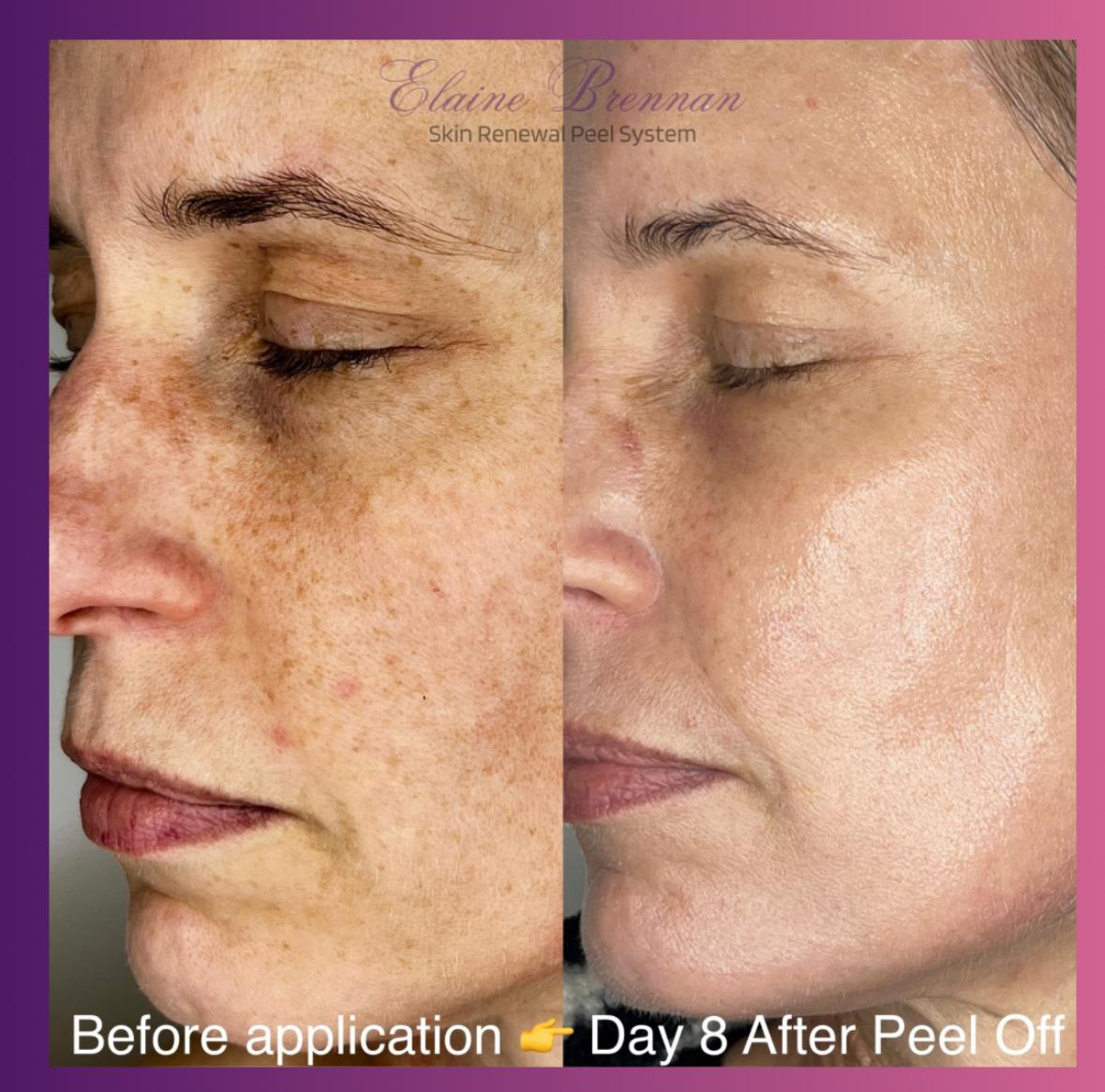 beforeafter