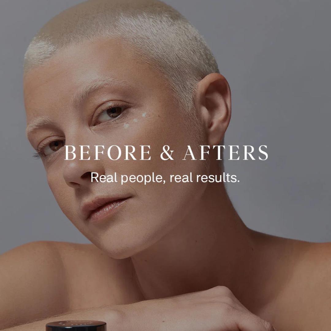 before and after