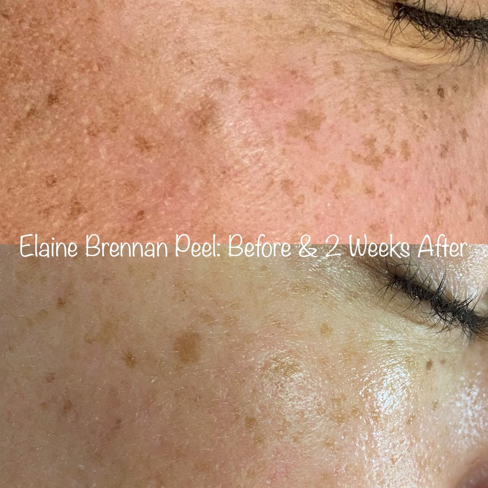 beforeafter1