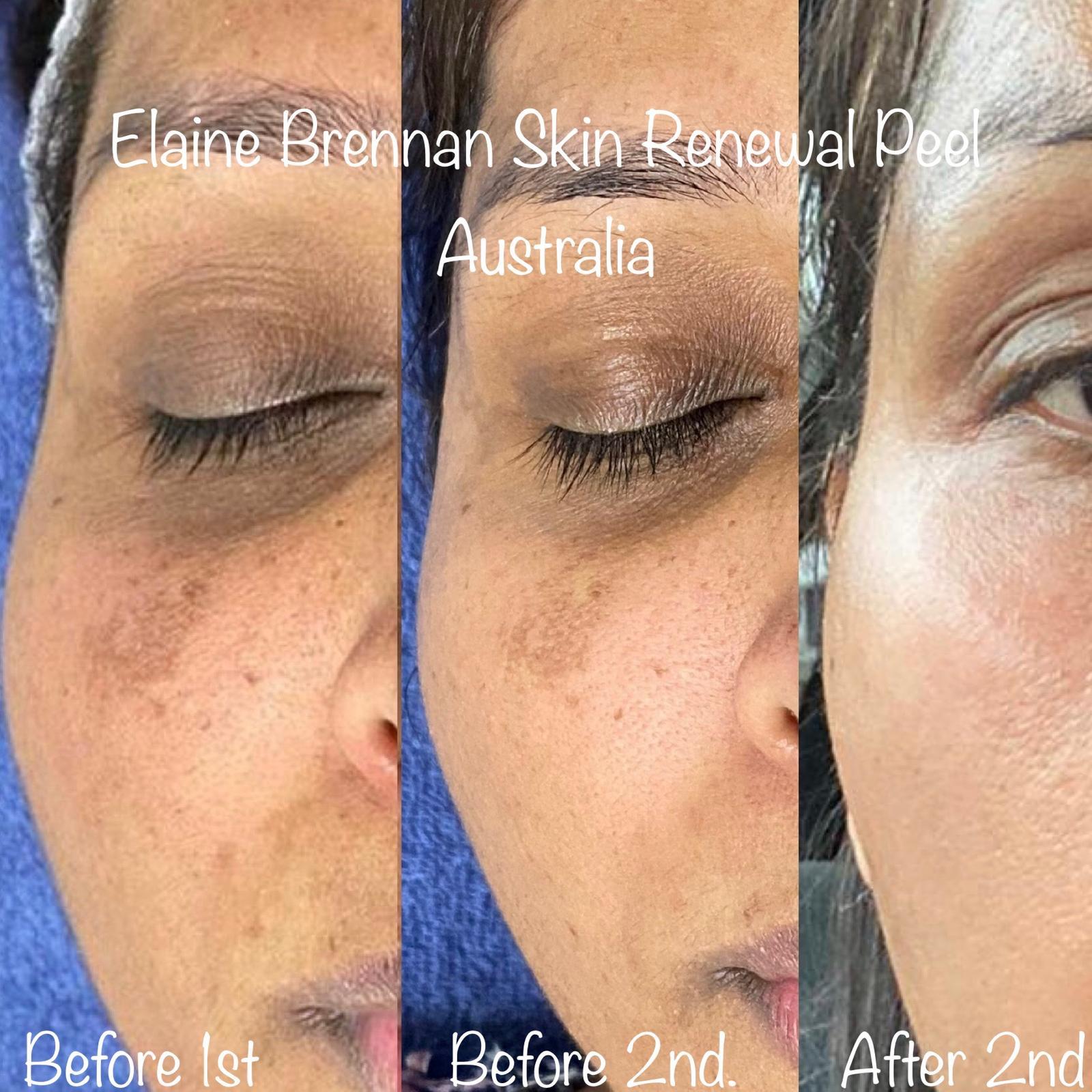 beforeafter3